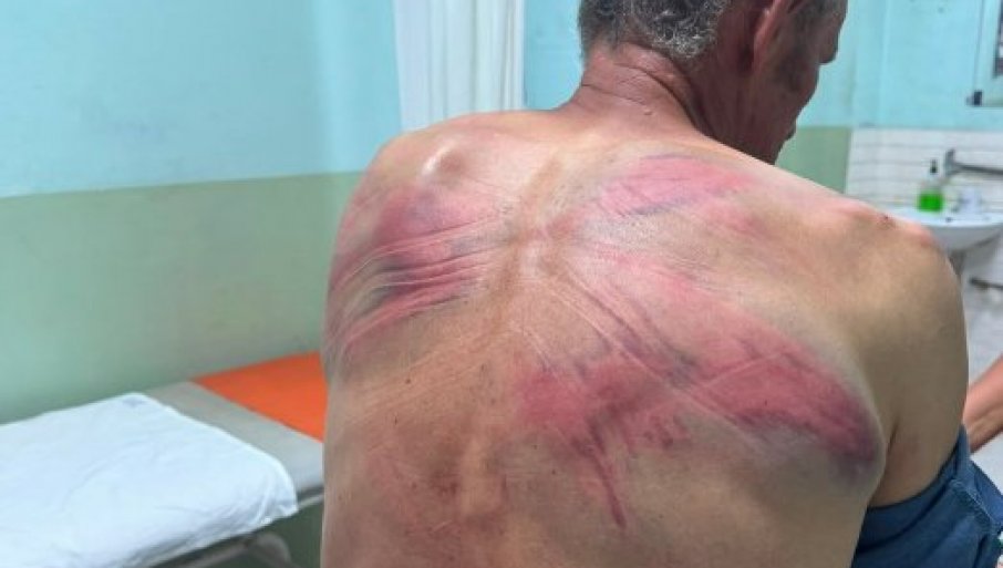 Simić: Suspenzija policajaca nije dovoljna, počinioci moraju odgovarati pred sudom
